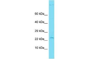 Host: Rabbit Target Name: CENPBD1 Sample Type: Hela Whole Cell lysates Antibody Dilution: 1. (CENPBD1 抗体  (N-Term))