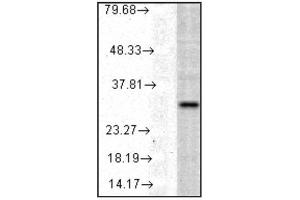 VAlidation of Detection Antibody: Western blot analysis of    HO-1 in a human cell line mix showing specificity at    ~32kDa (HMOX1 ELISA 试剂盒)
