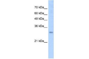 WB Suggested Anti-SOX15 Antibody Titration:  2. (SOX15 抗体  (N-Term))