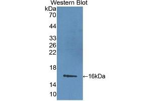 Detection of Recombinant LIMCH1, Mouse using Polyclonal Antibody to LIM And Calponin Homology Domains Containing Protein 1 (LIMCH1) (LIMCH1 抗体  (AA 21-125))