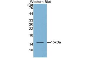 Western blot analysis of the recombinant protein. (HTRA1 抗体  (AA 304-442))
