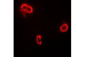 Immunofluorescent analysis of FRZB staining in A549 cells. (FRZB 抗体)