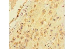 Immunohistochemistry of paraffin-embedded human placenta tissue using ABIN7168949 at dilution of 1:100 (Seryl-tRNA Synthetase (SARS) (AA 2-233) 抗体)