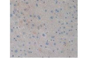 IHC-P analysis of Human Liver Tissue, with DAB staining. (CCK8 抗体)
