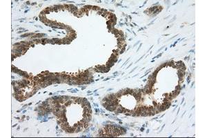 Immunohistochemical staining of paraffin-embedded Human Kidney tissue using anti-ACAT2 mouse monoclonal antibody. (ACAT2 抗体)