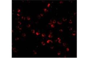 Immunofluorescence of ARF-BP1 in Daudi cells with AP30078PU-N ARF-BP1 antibody at 20 μg/ml.