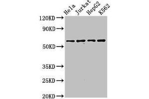 Western Blot Positive WB detected in: Hela whole cell lysate, Jurkat whole cell lysate, HepG2 whole cell lysate, K562 whole cell lysate All lanes: SMARCD1 antibody at 3. (SMARCD1 抗体  (AA 7-124))