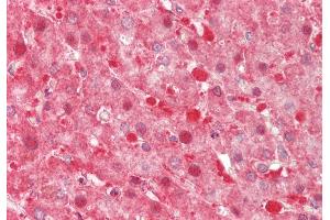 Rabbit Anti-TXN2 antibody Catalog Number: ARP54910 Formalin Fixed Paraffin Embedded Tissue: Human Liver Primary antibody Concentration: 1:200 Secondary Antibody: Donkey anti-Rabbit-Cy3 Secondary Antibody Concentration: 1:200 Magnification: 20x Exposure Time: 0. (TXN2 抗体  (Middle Region))