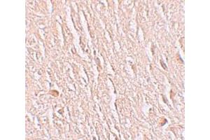 Immunohistochemistry (IHC) image for anti-Leucine Rich Repeat Transmembrane Neuronal 3 (LRRTM3) (C-Term) antibody (ABIN1030498) (LRRTM3 抗体  (C-Term))