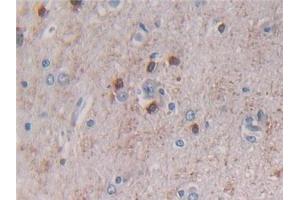 Detection of BECN1 in Human Cerebrum Tissue using Polyclonal Antibody to Beclin 1 (BECN1) (Beclin 1 抗体  (AA 1-273))