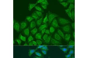 Immunofluorescence analysis of U2OS cells using PLOD1 Polyclonal Antibody at dilution of 1:100. (PLOD1 抗体)