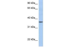 LFNG antibody used at 1 ug/ml to detect target protein. (LFNG 抗体  (N-Term))