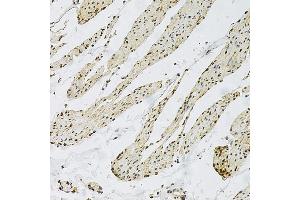 Immunohistochemistry of paraffin-embedded human smooth muscle using CD9 Rabbit pAb  at dilution of 1:100 (40x lens). (CD9 抗体  (AA 112-195))