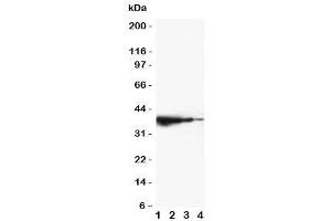 Western blot testing of TRIF antibody and mouse recombinant protein, 37. (TICAM1 抗体  (C-Term))
