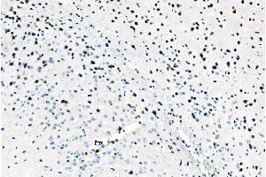 IHC analysis of ADAR1/ADAR using anti-ADAR1/ADAR antibody (ABIN7598956). (ADAR 抗体  (AA 1-1152))