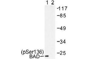 Image no. 1 for anti-BCL2-Associated Agonist of Cell Death (BAD) (pSer136), (pSer99) antibody (ABIN317969)