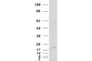 Western Blotting (WB) image for NTF2-Related Export Protein 1 (NXT1) protein (Myc-DYKDDDDK Tag) (ABIN2727839)