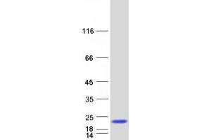 Western Blotting (WB) image for Sorting Nexin 3 (SNX3) (Transcript Variant 1) protein (Myc-DYKDDDDK Tag) (ABIN2732404)