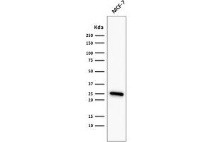 Western Blot Analysis of MCF-7 cell lysate using Bcl-2 Mouse Recombinant Monoclonal Antibody (rBCL2/782). (Recombinant Bcl-2 抗体)