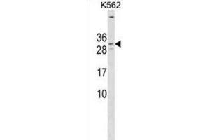 Western Blotting (WB) image for anti-Potassium Voltage-Gated Channel, Isk-Related Family, Member 4 (KCNE4) antibody (ABIN3000252) (KCNE4 抗体)