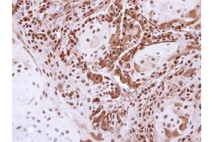 IHC-P Image Immunohistochemical analysis of paraffin-embedded Cal27 Xenograft , using DDB1, antibody at 1:500 dilution. (DDB1 抗体  (C-Term))