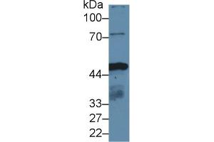 Detection of IDH1 in Human HepG2 cell lysate using Polyclonal Antibody to Isocitrate Dehydrogenase 1, Soluble (IDH1) (IDH1 抗体  (AA 74-333))