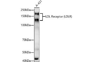 Western blot analysis of extracts of A-431 cells, using LDL Receptor (LDLR) antibody  at 1:1000 dilution. (LDLR 抗体)