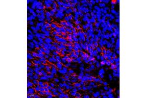Immunofluorescence (Paraffin-embedded Sections) (IF (p)) image for anti-General Transcription Factor IIIC, Polypeptide 2, beta 110kDa (GTF3C2) antibody (ABIN7074038)