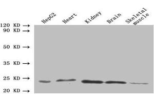 Western blot All lanes: ORM2 antibody at 1. (Orosomucoid 2 抗体  (AA 19-201))