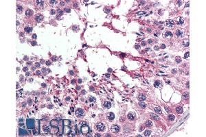 ABIN185164 (5µg/ml) staining of paraffin embedded Human Testis. (Exportin 7 抗体  (C-Term))
