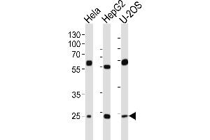 Western blot analysis of lysates from Hela, HepG2, U-2OS cell line (from left to right), using TF Antibody (C-term) (ABIN654229 and ABIN2844063).
