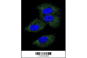 Confocal immunofluorescent analysis of M-CSF Antibody with MDA-MB231 cell followed by Alexa Fluor 488-conjugated goat anti-rabbit lgG (green). (M-CSF/CSF1 抗体  (AA 230-257))