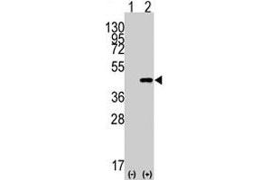 Western blot analysis of CDX2 (arrow) using rabbit CDX2 polyclonal antibody  . (CDX2 抗体  (N-Term))