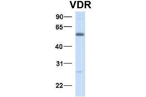 Western Blotting (WB) image for anti-Vitamin D Receptor (VDR) (N-Term) antibody (ABIN2776857)
