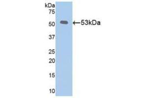 WB of Protein Standard: different control antibodies  against Highly purified E. (Klotho ELISA 试剂盒)