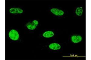 Immunofluorescence of monoclonal antibody to HOXA5 on HeLa cell. (HOXA5 抗体  (AA 171-270))