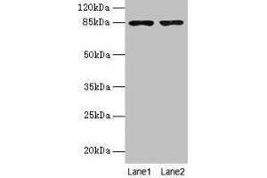 Western blot All lanes: FCHSD2 antibody at 12 μg/mL Lane 1: U251 whole cell lysate Lane 2: A549 whole cell lysate Secondary Goat polyclonal to rabbit IgG at 1/10000 dilution Predicted band size: 85, 78, 59 kDa Observed band size: 85 kDa (FCHSD2 抗体  (AA 1-290))