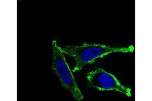 Immunofluorescence analysis of Hela cells using ITGAM mouse mAb (green). (CD11b 抗体  (AA 623-728))