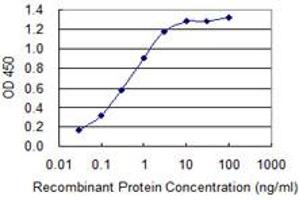 Detection limit for recombinant GST tagged S100B is 0. (S100B 抗体  (AA 1-92))