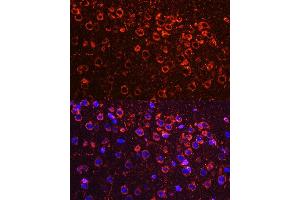 Immunofluorescence analysis of mouse brain using YB-1/YB-1/YBX1 antibody (ABIN6134494, ABIN6150328, ABIN6150330 and ABIN7101815) at dilution of 1:100. (YBX1 抗体  (AA 100-200))