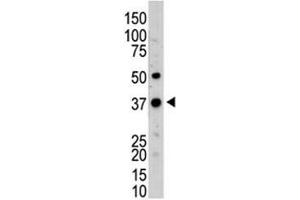 Western blot testing of UCH37 antibody and mouse kidney tissue lysate (UCHL5 抗体  (AA 56-87))