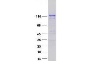 Validation with Western Blot