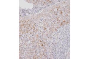 Immunohistochemical analysis of B on paraffin-embedded Human tonsil tissue. (CSF1R 抗体  (C-Term))