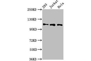 Western Blot Positive WB detected in: 293 whole cell lysate, Jurkat whole cell lysate, Hela whole cell lysate All lanes: RAB3GAP1 antibody at 7 μg/mL Secondary Goat polyclonal to rabbit IgG at 1/50000 dilution Predicted band size: 111, 112, 106 kDa Observed band size: 111 kDa (RAB3GAP1 抗体  (Catalytic Subunit))