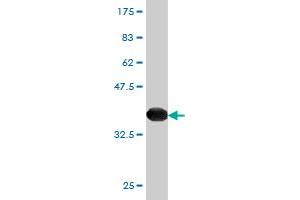 Western Blot detection against Immunogen (36. (Peroxiredoxin 4 抗体  (AA 51-150))
