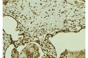 ABIN6269347 at 1/100 staining Mouse colon tissue by IHC-P. (G3BP1 抗体  (Internal Region))