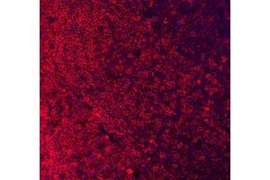 IF analysis of CD79A using anti-CD79A antibody (ABIN3043397). (CD79a 抗体  (AA 121-226))