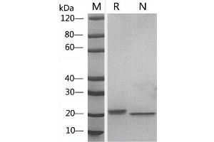 SDS-PAGE (SDS) image for Leukemia Inhibitory Factor (LIF) (AA 24-203) (Active) protein (ABIN2018198)