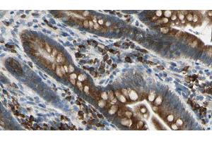 ABIN6274670 at 1/100 staining Mouse intestine tissue by IHC-P. (GRID1 抗体  (Internal Region))