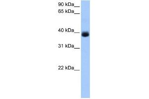 Western Blotting (WB) image for anti-serpin Peptidase Inhibitor, Clade A (Alpha-1 Antiproteinase, Antitrypsin), Member 5 (SERPINA5) (C-Term) antibody (ABIN634035)